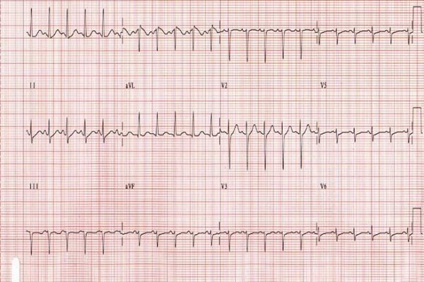 Сайт кракен онион