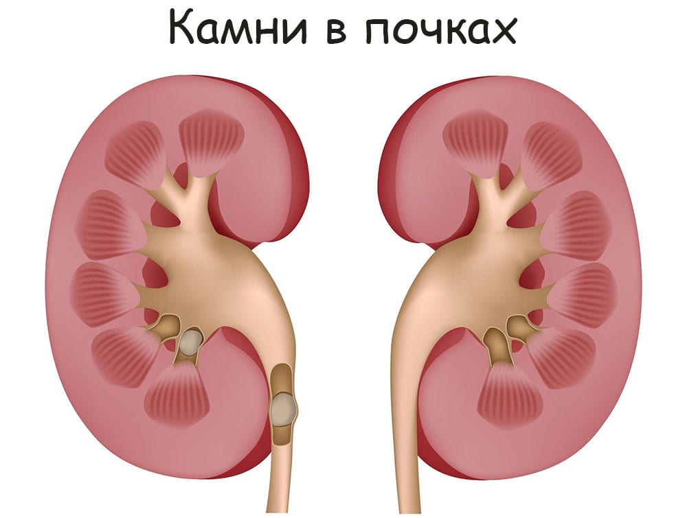 Ссылка на кракен зеркало